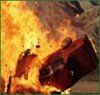 burn-victim.jpg