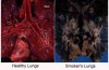 smokers%20lungs.jpg
