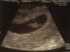 baby1st.jpg
